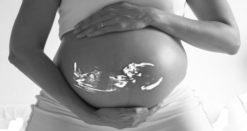 maternal-age-neurodevelopment-neurosciencenews-public.jpg